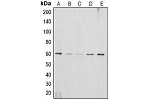 Western blot analysis of AKT2 expression in HeLa (A), HepG2 (B), NIH3T3 (C), mouse brain (D), rat brain (E) whole cell lysates. (AKT2 Antikörper  (C-Term))