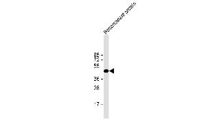 H1L recombinant protein probed with H1L (20CT26. (Tyr/ser Protein Phosphatase Antikörper)