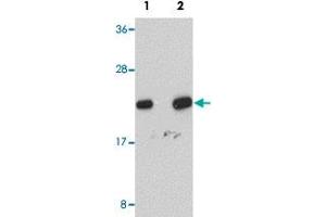 Western blot analysis of human liver tissue with NDUFB9 polyclonal antibody  at (Lane 1) 1 and (Lane 2) 2 ug/mL dilution.