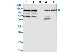 Ras Protein-Specific Guanine Nucleotide-Releasing Factor 2 (RASGRF2) 抗体