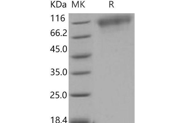 NTRK3 Protein (His tag)