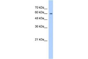 WB Suggested Anti-ATIC Antibody Titration:  1. (ATIC Antikörper  (N-Term))