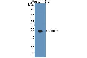 Western blot analysis of the recombinant protein. (GAS6 Antikörper  (AA 503-664))