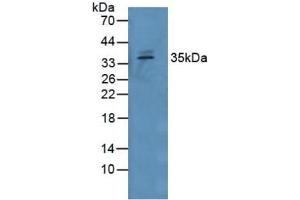 Western blot analysis of Human Serum. (GDF15 Antikörper  (AA 195-308))
