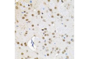 Immunohistochemistry (IHC) image for anti-SWI/SNF Related, Matrix Associated, Actin Dependent Regulator of Chromatin, Subfamily D, Member 1 (SMARCD1) (AA 1-120) antibody (ABIN6137420)