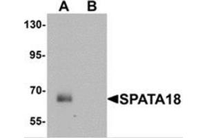 Western blot analysis of SPATA18 in rat lung tissue lysate with SPATA18 antibody at 1 ug/mL in (A) the absence and (B) the presence of blocking peptide (SPATA18 Antikörper  (N-Term))