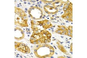 Immunohistochemistry of paraffin-embedded human kidney using CXCR3 Antibody. (CXCR3 Antikörper)