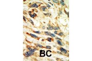 Immunohistochemistry (Paraffin-embedded Sections) (IHC (p)) image for anti-serum/glucocorticoid Regulated Kinase 2 (SGK2) (AA 1-30), (N-Term) antibody (ABIN1882131)