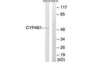 Western blot analysis of extracts from COLO cells, using Cytochrome P450 4B1 Antibody. (CYP4B1 Antikörper  (AA 141-190))