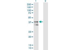 Western Blot analysis of ART4 expression in transfected 293T cell line by ART4 MaxPab polyclonal antibody. (ART4 Antikörper  (AA 1-314))