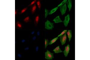 Phospho-MAP3K3 (Ser166) Antibody staining A549 cells(H2O2 treatment) by IF/ICC.