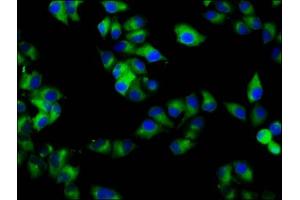 Immunofluorescence staining of Hela cells with ABIN7167381 at 1:133, counter-stained with DAPI. (RAB7B Antikörper  (AA 100-199))