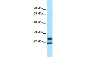 WB Suggested Anti-YRDC Antibody Titration: 1. (YRDC Antikörper  (Middle Region))