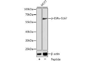 Western blot analysis of extracts from MCF7 cells using Phospho-ESRα-S167 antibody (ABIN3020207, ABIN3020208, ABIN3020209 and ABIN7101869). (Estrogen Receptor alpha Antikörper  (pSer167))