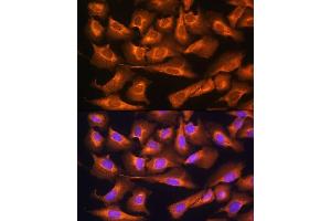 Immunofluorescence analysis of U2OS cells using RPS28 Rabbit pAb (ABIN7270024) at dilution of 1:100. (RPS28 Antikörper)