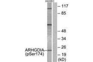 Western blot analysis of extracts from HuvEc cells treated with EGF 200ng/ml 30', using ARHGDIA (Phospho-Ser174) Antibody. (ARHGDIA Antikörper  (pSer174))