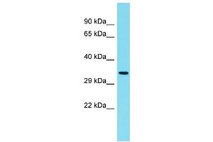 Host: Rabbit Target Name: C6orf136 Sample Type: Fetal Kidney lysates Antibody Dilution: 1. (C6ORF136 Antikörper  (C-Term))
