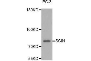 Western blot analysis of extracts of PC-3 cell line, using SCIN antibody. (Scinderin Antikörper)