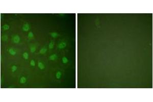 Immunofluorescence analysis of HeLa cells, using POLR2A (Ab-1619) Antibody. (POLR2A/RPB1 Antikörper  (AA 1585-1634))
