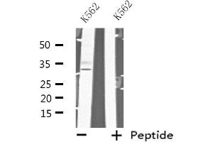 Western blot analysis of extracts from K562 cells, using MAD2L1BP antibody.