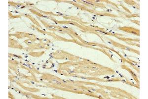 IHC image of ABIN7160149 diluted at 1:400 and staining in paraffin-embedded human heart tissue performed on a Leica BondTM system. (ABHD6 Antikörper  (AA 105-211))