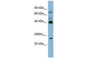 Image no. 1 for anti-Transglutaminase 3 (E Polypeptide, Protein-Glutamine-gamma-Glutamyltransferase) (TGM3) (N-Term) antibody (ABIN6741686) (TGM3 Antikörper  (N-Term))