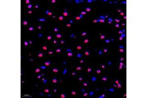 Immunofluorescence of paraffin embedded mouse brain using PRPF4 (ABIN7075312) at dilution of 1: 500 (400x lens) (PRPF4 Antikörper)