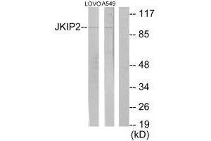 Western blot analysis of extracts from LOVO cells and A549 cells, using JKIP2 antibody. (JAKMIP2 Antikörper  (C-Term))