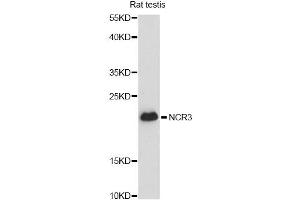 Western blot analysis of extracts of rat testis, using CALM3 antibody (ABIN6294040) at 1:3000 dilution. (Calmodulin 3 Antikörper)