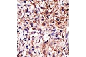 Image no. 2 for anti-Cell Cycle Associated Protein 1 (Caprin-1) (C-Term) antibody (ABIN357728) (Caprin-1 Antikörper  (C-Term))
