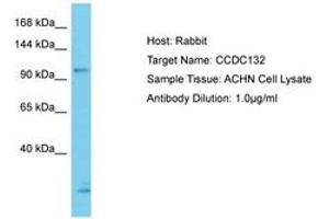 Image no. 1 for anti-Coiled-Coil Domain Containing 132 (CCDC132) (N-Term) antibody (ABIN6750636) (Syndetin/VPS50 Antikörper  (N-Term))