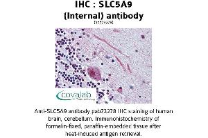 Image no. 1 for anti-Solute Carrier Family 5 (Sodium/glucose Cotransporter), Member 9 (SLC5A9) (Internal Region) antibody (ABIN1739410) (SLC5A9 Antikörper  (Internal Region))