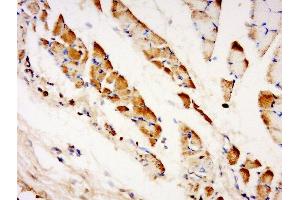 Paraformaldehyde-fixed, paraffin embedded human muscle tissue, Antigen retrieval by boiling in sodium citrate buffer (pH6) for 15min, Block endogenous peroxidase by 3% hydrogen peroxide for 30 minutes, Blocking buffer (normal goat serum) at 37°C for 20min, Antibody incubation with TXLNB Polyclonal Antibody, Unconjugated  at 1:500 overnight at 4°C, followed by a conjugated secondary and DAB staining. (Taxilin beta Antikörper  (AA 331-430))