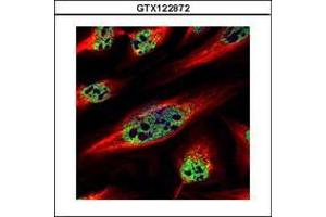 Image no. 2 for anti-Zinc Finger Protein 689 (ZNF689) (AA 28-240) antibody (ABIN1501852) (ZNF689 Antikörper  (AA 28-240))