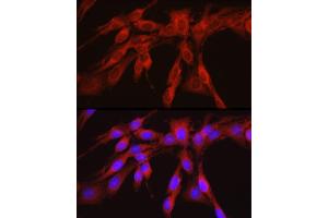 Immunofluorescence (IF) image for anti-phosphoglycerate Dehydrogenase (PHGDH) (AA 264-533) antibody (ABIN6145554)