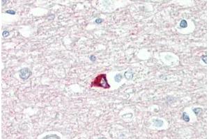 Image no. 2 for anti-Synaptosomal-Associated Protein, 25kDa (SNAP25) (AA 151-200) antibody (ABIN2879129) (SNAP25 Antikörper  (AA 151-200))