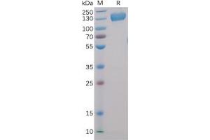 Human CD22, hFc-His Tag on SDS-PAGE under reducing condition.