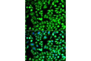 Immunofluorescence analysis of A549 cells using ALKBH4 antibody. (ALKBH4 Antikörper)