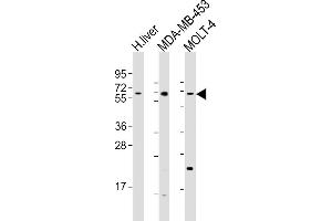 All lanes : Anti-OPN-a/b Antibody (N-term) at 1:1000 dilution Lane 1: human liver lysates Lane 2: MDA-MB-453 whole cell lysates Lane 3: MOLT-4 whole cell lysates Lysates/proteins at 20 μg per lane. (OPN-A,b (AA 14-40), (N-Term) Antikörper)