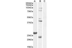 ABIN768639 (1µg/ml) staining of Mouse Testes lysate 1 (A) and Testes lysate 2 (B) + peptide (C) (35µg protein in RIPA buffer). (FGF23 Antikörper  (Internal Region))