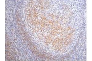 Immunohistochemistry (IHC) image for anti-Fc Fragment of IgE, Low Affinity II, Receptor For (CD23) (FCER2) antibody (ABIN3178602) (FCER2 Antikörper)