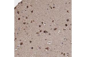 Immunohistochemical staining of human cerebral cortex with ODZ1 polyclonal antibody  shows strong cytoplasmic positivity in neuronal cells at 1:10-1:20 dilution. (ODZ1/Teneurin 1 Antikörper)