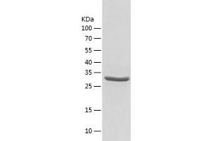 Western Blotting (WB) image for Sulfotransferase Family, Cytosolic, 2B, Member 1 (SULT2B1) (AA 1-311) protein (His tag) (ABIN7284224) (SULT2B1 Protein (AA 1-311) (His tag))