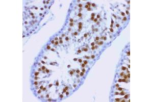 Anti-MCAK antibody, (ABIN3043278), IHC(P)IHC(P): Rat Testis Tissue (KIF2C Antikörper  (AA 531-725))