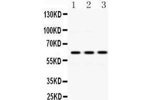 Western Blotting (WB) image for anti-Crossover junction endonuclease EME1 (EME1) (AA 520-561), (C-Term) antibody (ABIN3042370) (Crossover junction endonuclease EME1 (EME1) (AA 520-561), (C-Term) Antikörper)
