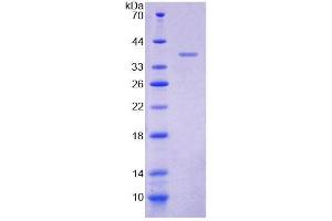 SDS-PAGE (SDS) image for Myomesin 2 (MYOM2) (AA 1130-1434) protein (His tag) (ABIN6237216)