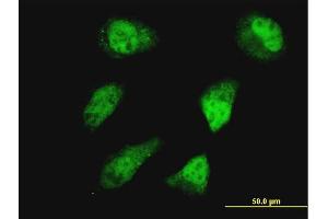 Immunofluorescence of monoclonal antibody to HOXD11 on HeLa cell. (HOXD11 Antikörper  (AA 1-76))