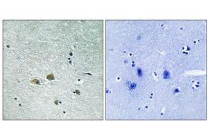 Immunohistochemistry analysis of paraffin-embedded human brain tissue using PAK1 (epitope around residue 204) antibody.