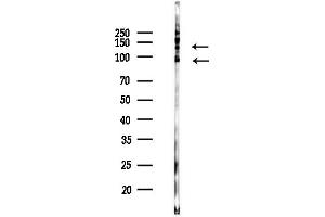 anti-Inositol Polyphosphate-5-Phosphatase, 145kDa (INPP5D) (pTyr1020) antibody