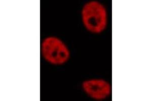 ABIN6276858 staining  MCF7 cells by IF/ICC. (POLR2E Antikörper  (Internal Region))